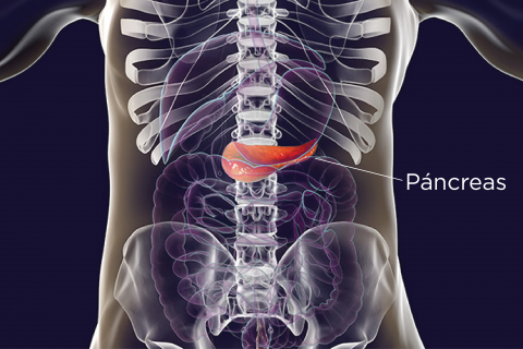 diabetes tipo 2 y páncreas